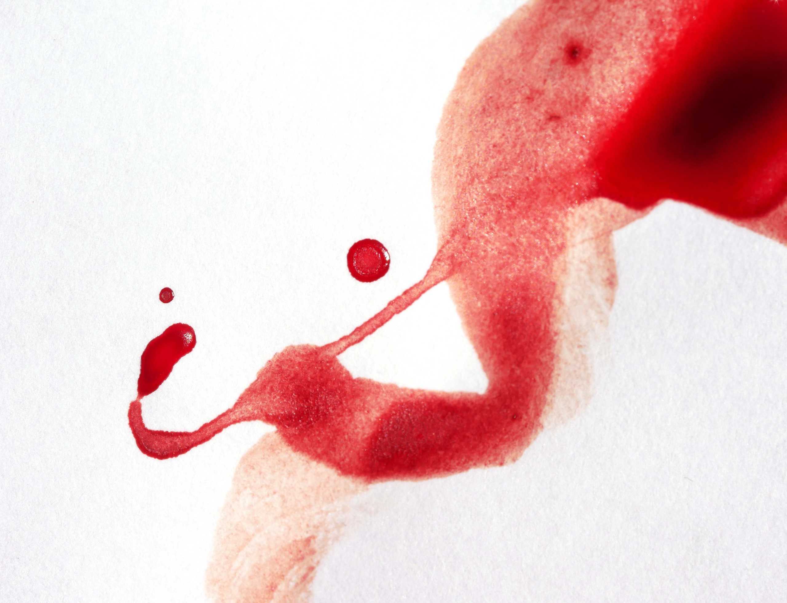 When period blood turns into art: A photo gallery