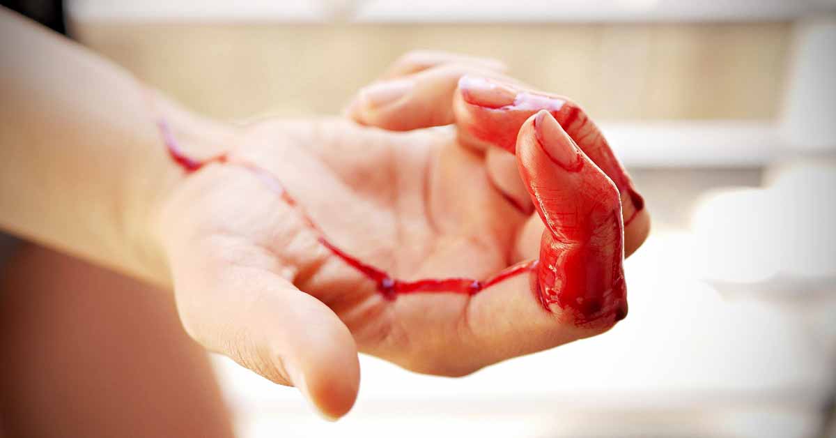 Being homeless and periods: Bleeding in the streets?