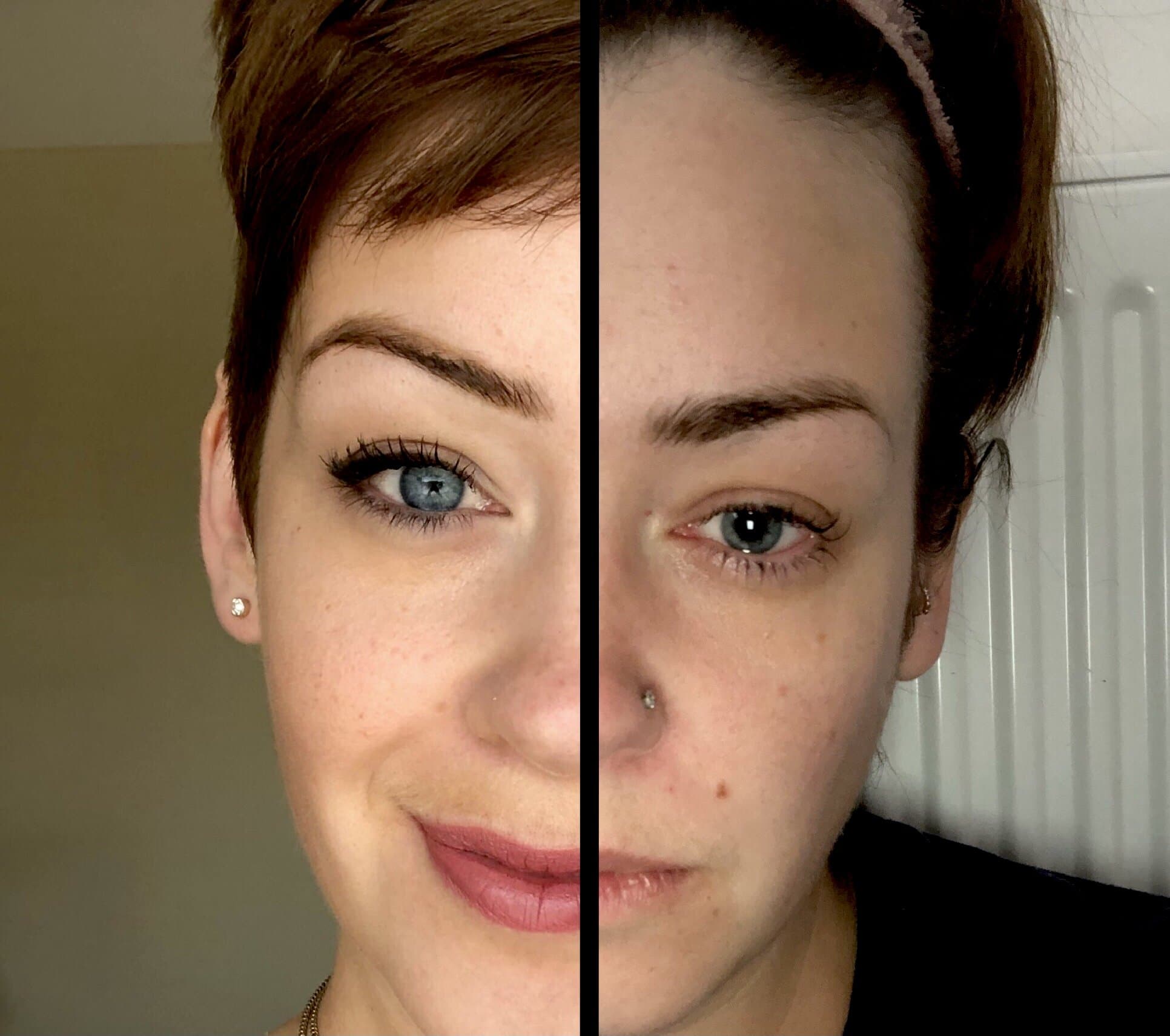 Living with PMDD: More than PMS